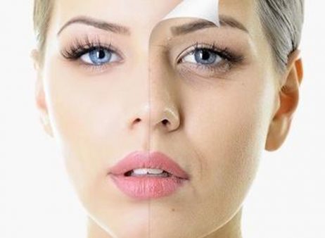 Skin Tightening in Lancashire - Permanent Perfection Aesthetics