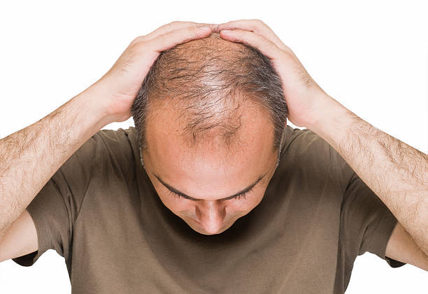 Man with thinning hair