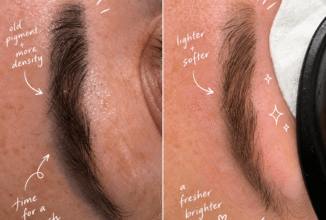 Why Your Permanent Makeup May Benefit From a Little Laser Lightening Before a Colour Boost