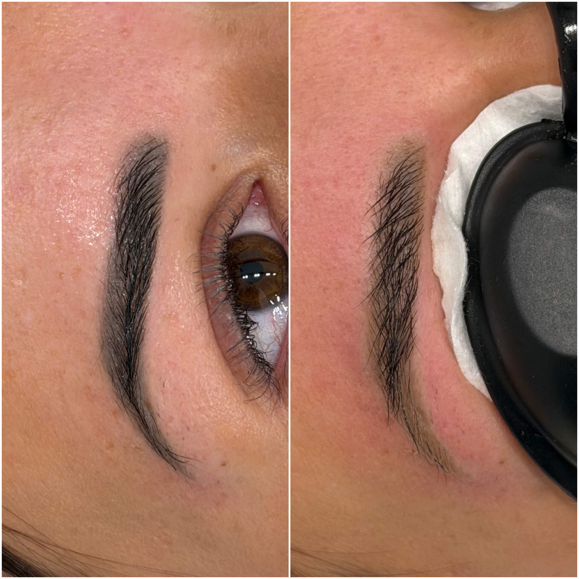 Image showing the same tattooed eyebrow before and after laser